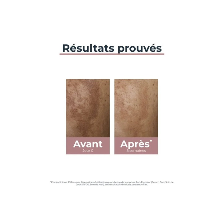 EUCERIN Serum Duo Anti Pigment 30ml
